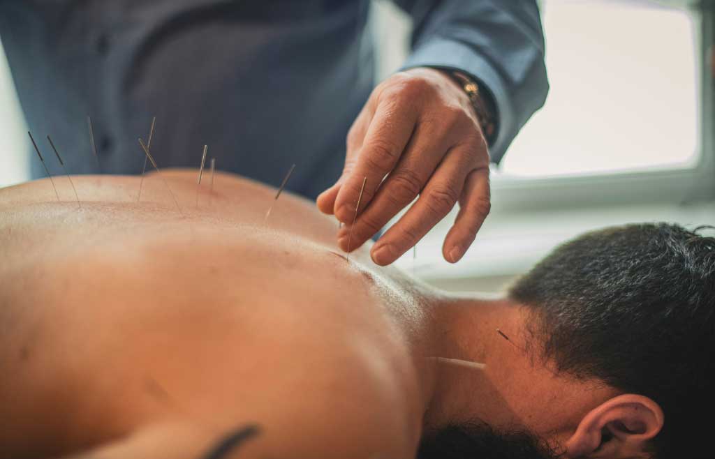 Services-d'acupuncture-à-forest-uccle-ixelles-st-Gilles