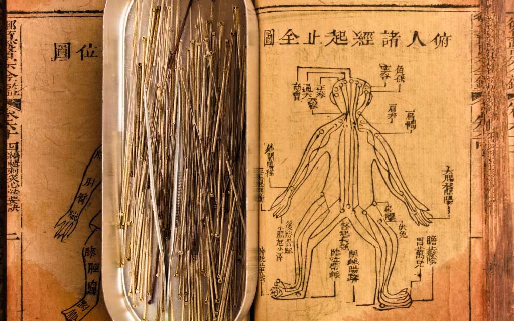 acupuncture-medecine-traditionnelle-chinoise-curatia-centre-pluridisciplinaire-à-uccle